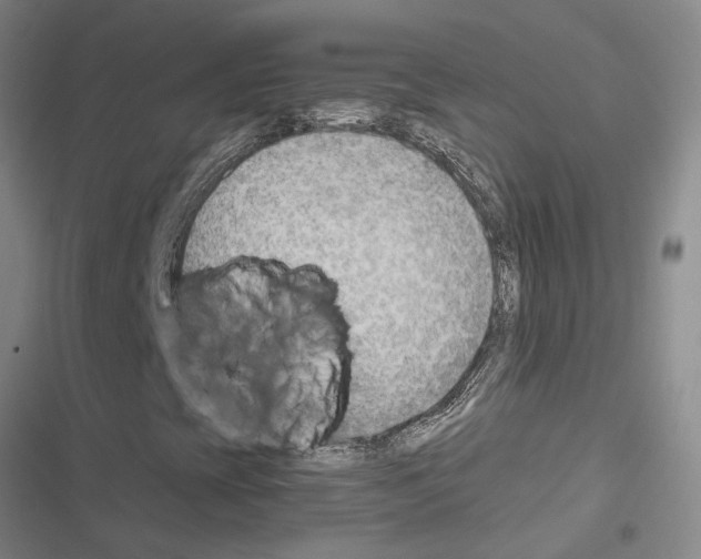 X0000116651393201001251147