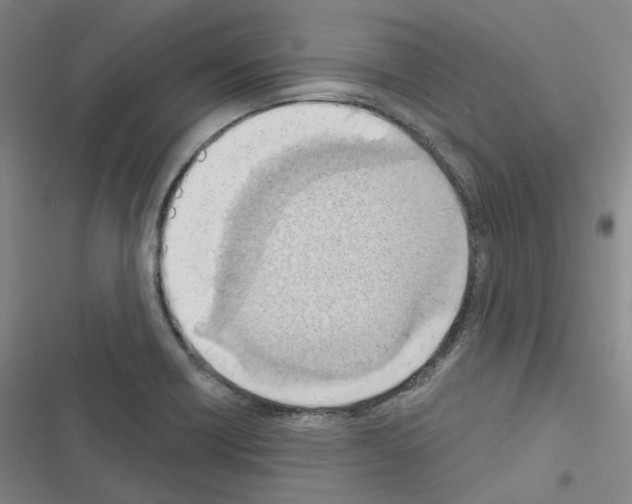 X0000116651418201001251147