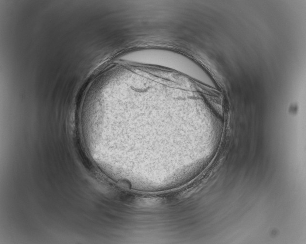 X0000116660202201001111257