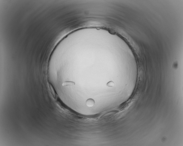 X0000116661473201001111240