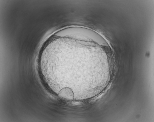 X0000116660151201001251225