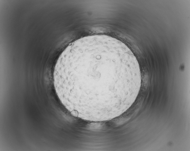 X0000116660418201001251222