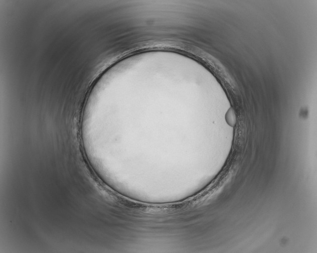 X0000116660985201001251214