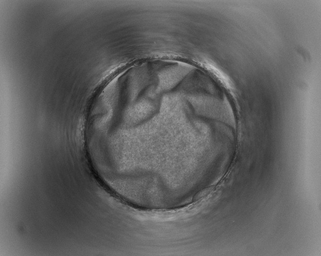 X0000116670009201001041138