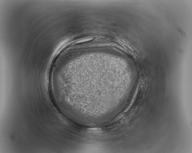 X0000116670053201001041137