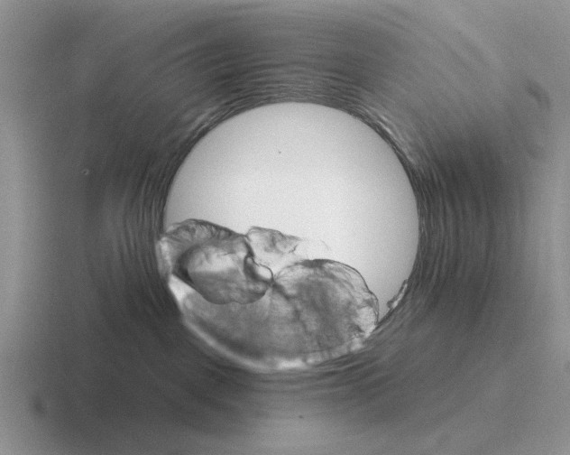 X0000116670093201001041138