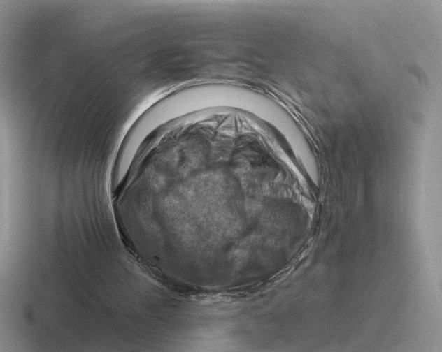 X0000116670100201001041137