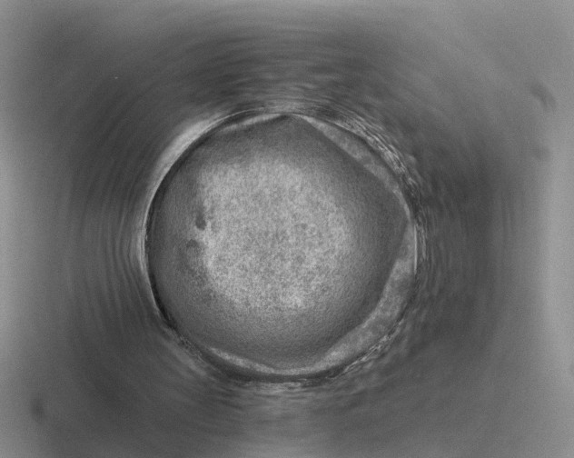 X0000116670147201001041136