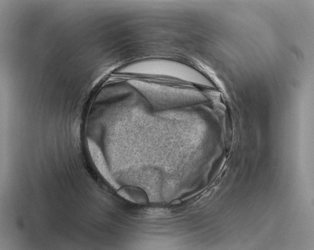 X0000116670154201001041136