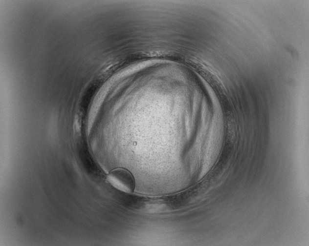 X0000116670214201001041136