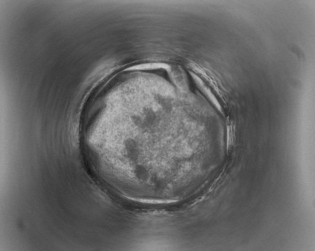 X0000116670243201001041135