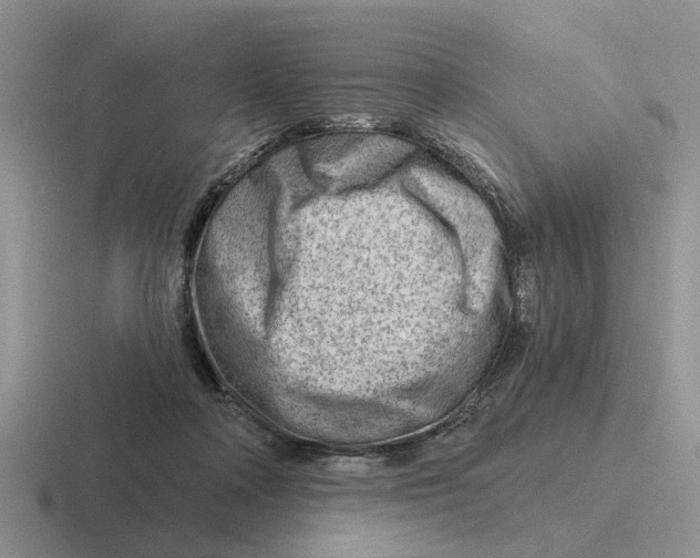 X0000116670314201001041134