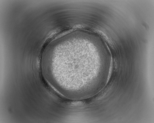 X0000116670357201001041134