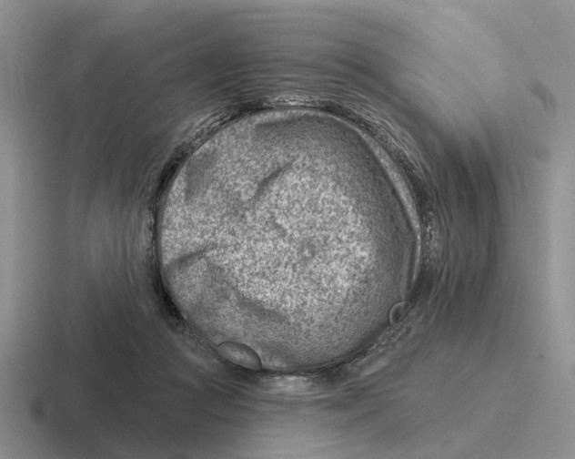 X0000116670361201001041134