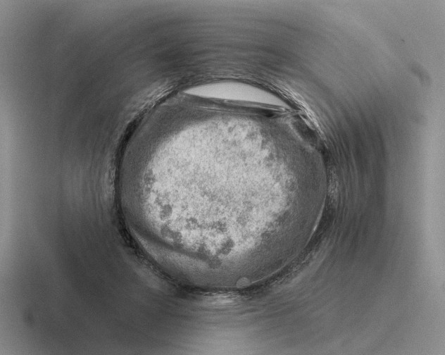 X0000116670402201001041133