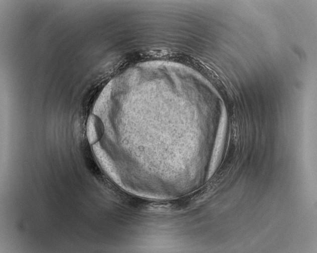 X0000116670606201001041131