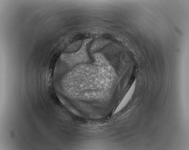 X0000116670818201001041127