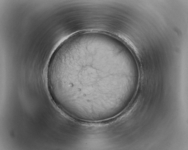 X0000116670941201001041126