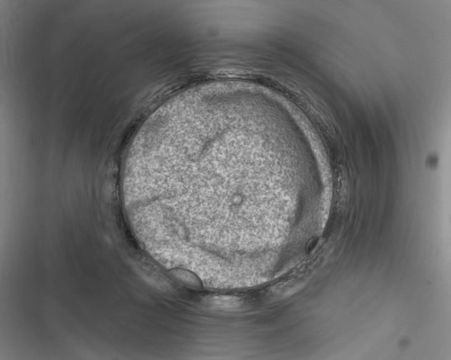 X0000116670361201001111316