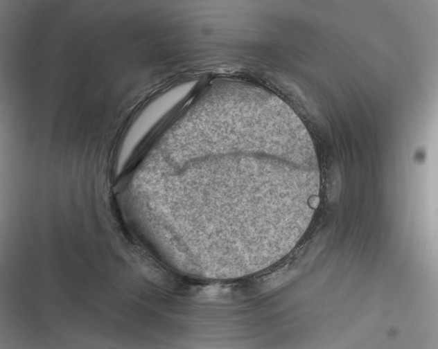 X0000116670366201001111316