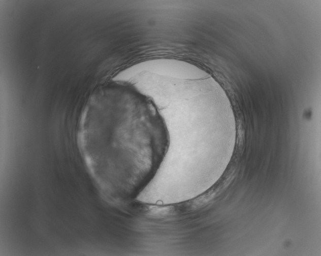 X0000116670185201001251246