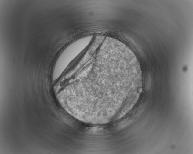 X0000116670366201001251244