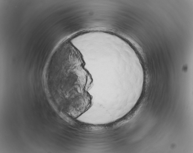 X0000116670933201001251236