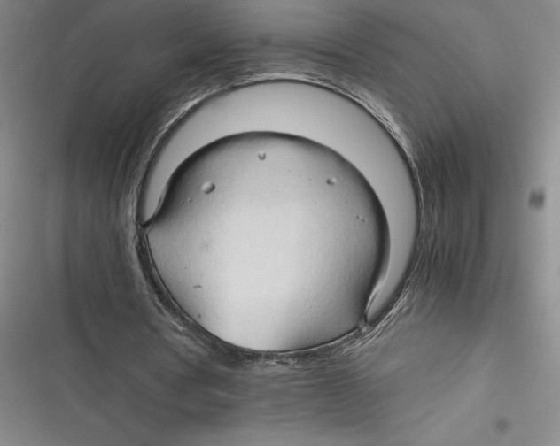 X0000116680386201001111336