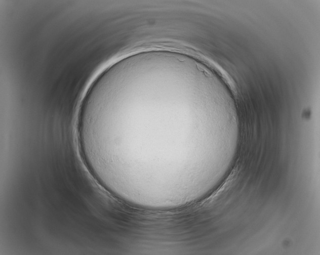 X0000116681514201001111321