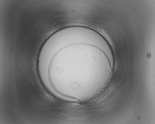 X0000116680393201001251304