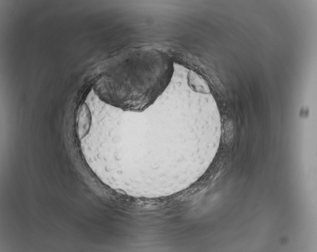 X0000116680913201001251257