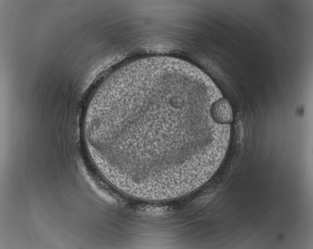 X0000116760638201001071156