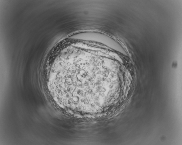 X0000116760145201001141437