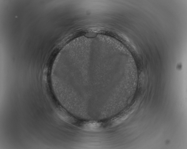 X0000116760217201001141436