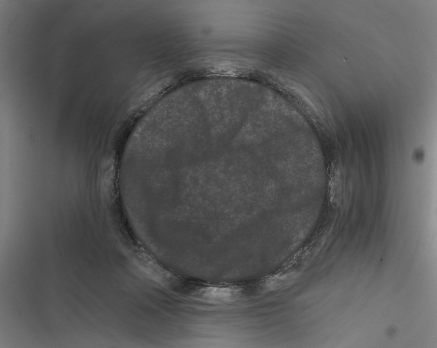 X0000116760314201001141435