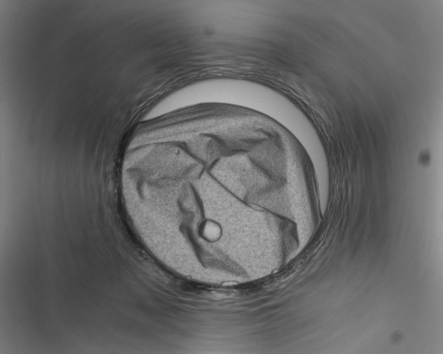 X0000116760317201001141435