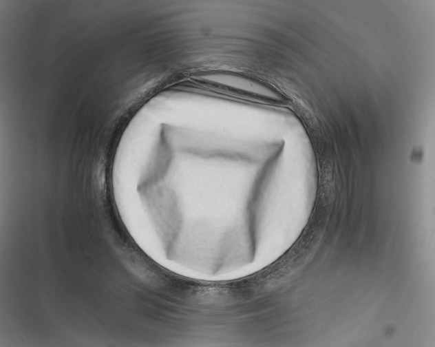 X0000116760398201001141434