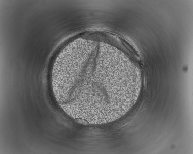 X0000116760531201001141431