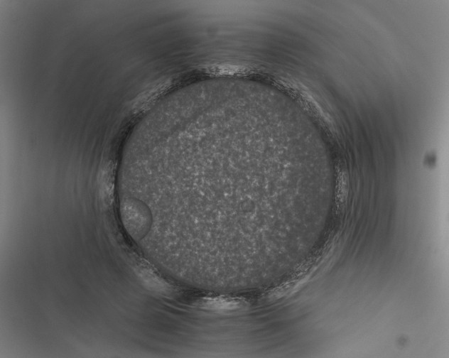 X0000116760545201001141432