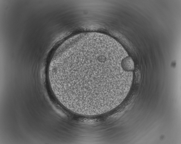 X0000116760638201001141430