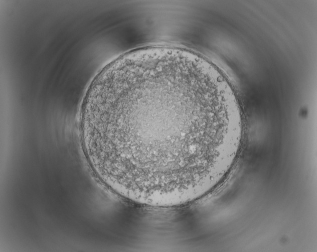 X0000116760856201001141428