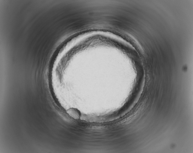 X0000116761035201001141425