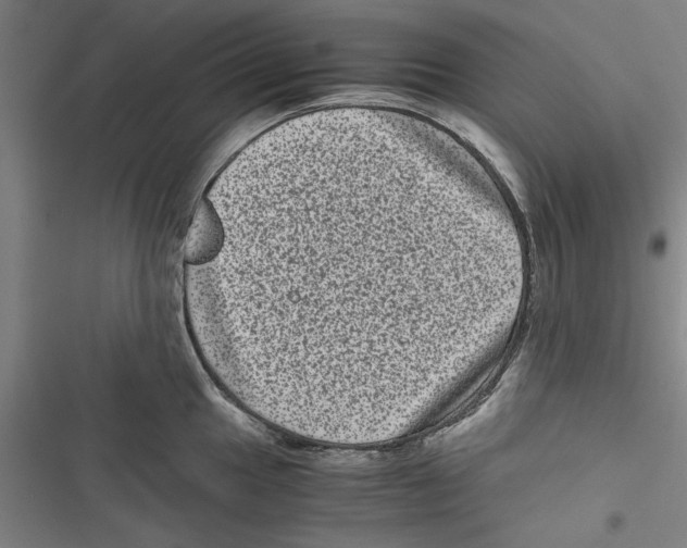 X0000116761049201001141425