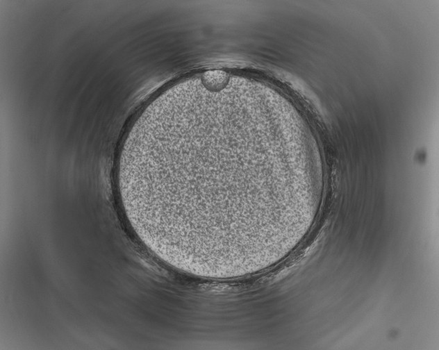 X0000116761217201001141422