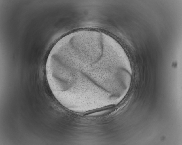 X0000116761358201001141421