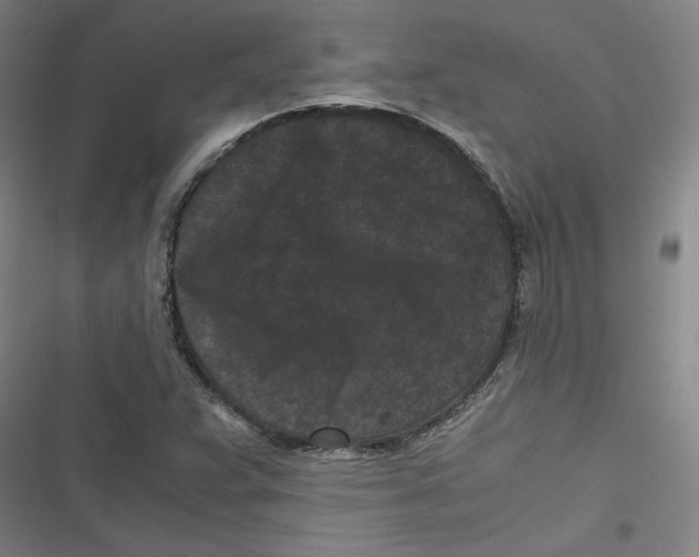 X0000116761359201001141421