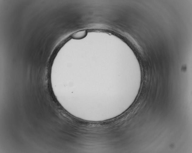 X0000116761364201001141421