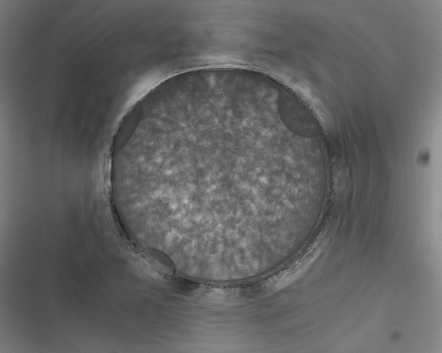 X0000116761365201001141421