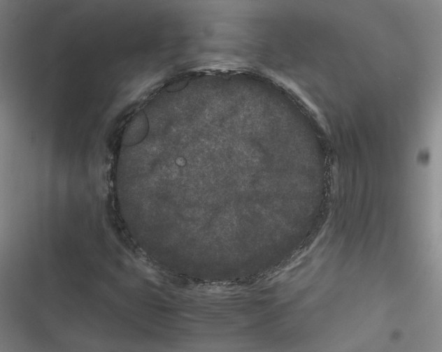 X0000116761399201001141420