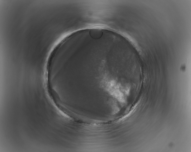 X0000116761414201001141420